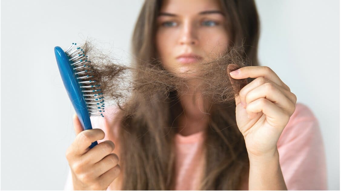 ماهي زراعة الشعر ؟ أكثر الطرق فعالية لزراعة الشعر في مناطق الصلع