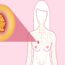 ما الذي يسبب سرطان الثدي ؟ الأعراض والعلاج والفحص اليدوي