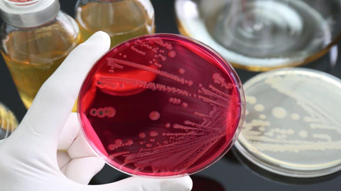 ما هي بكتيريا السالمونيلا؟ كيف تنتقل؟ الأعراض والعلاج