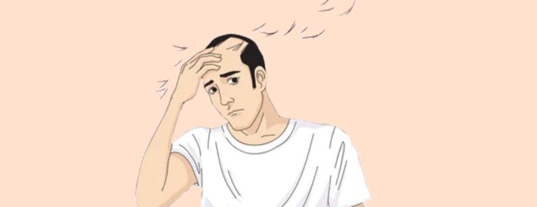ما هو تساقط الشعر الكربي: الأسباب والأعراض والعلاج