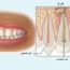 خراج الاسنان: الاسباب والاعراض والعلاج