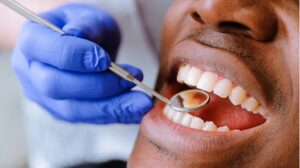 ما هي عواقب عدم تنظيف الاسنان بشكل كافي؟