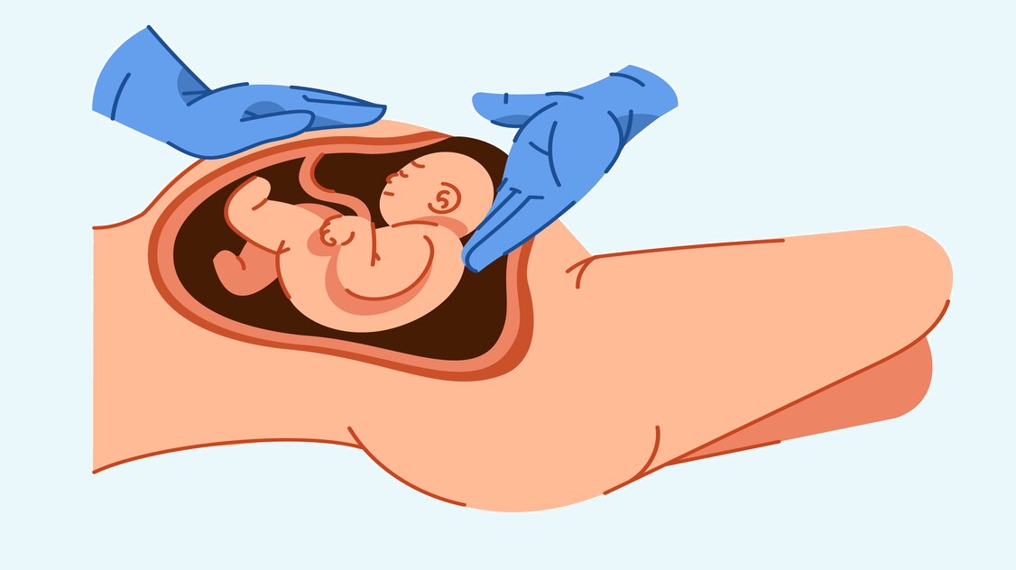 لماذا يتم توسيع عنق الرحم للولادة باليد؟