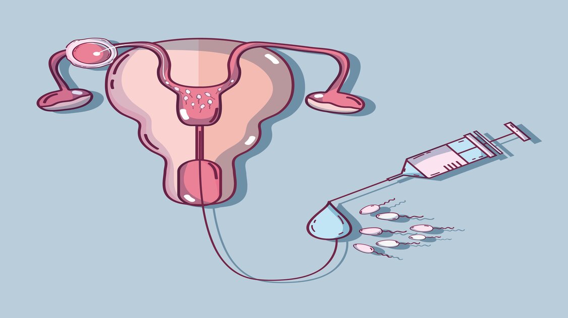 ما هي اعراض الحمل بعد ترجيع الاجنة اليوم الخامس؟