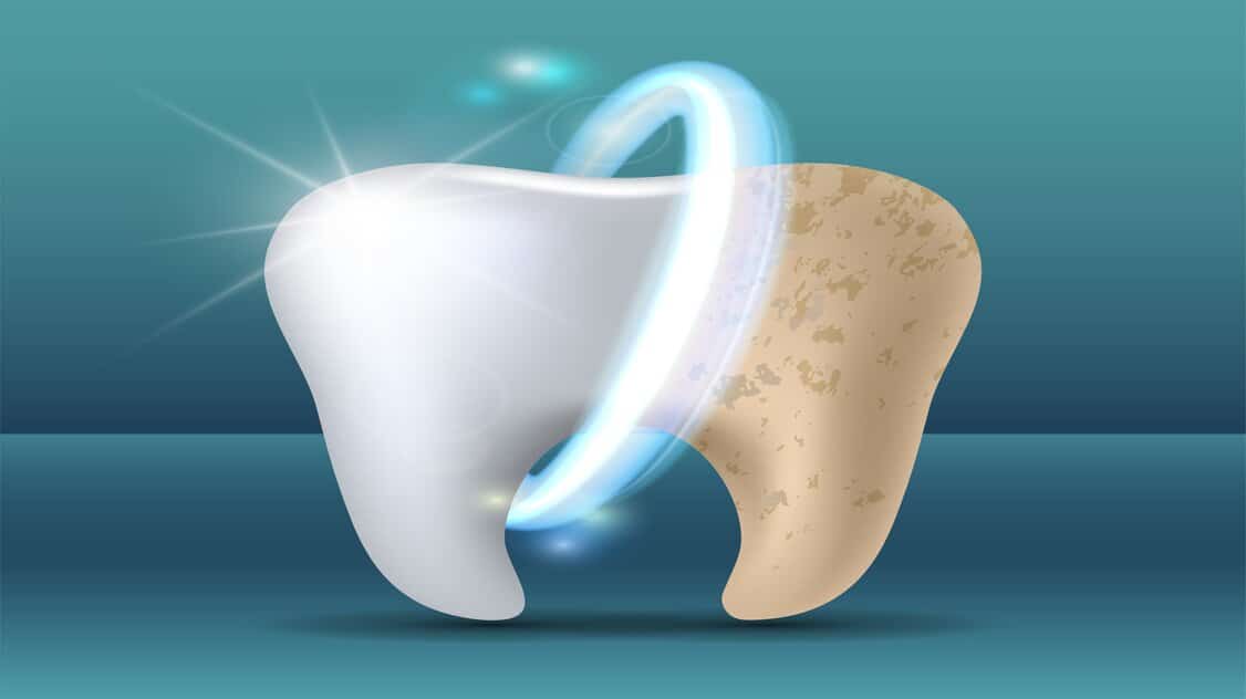 ما هي فوائد واضرار بودرة تبييض الاسنان؟